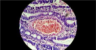Bacterias modificadas