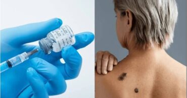 Vacuna contra el melanoma